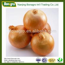 bulk brown onion