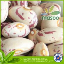 High Quality Light Speckled Kidney Beans Round Shape American Type