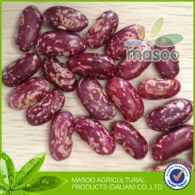 High quality kidney bean,  purple   speckled  bean kidney, various type of bean/kidney in China