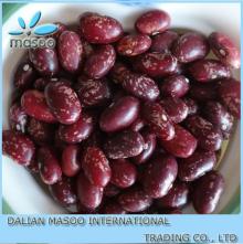 Round Type of Purple Speckled Kidney Beans PSKB
