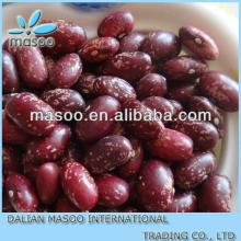New crop large medium small size, long and  round   shape   kidney   bean , wholesale all types of  bean s