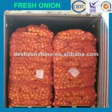 The best market onions prices