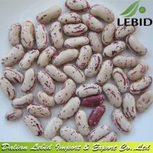 Light Speckled Kidney Beans Long Shape