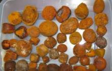 dried gallstone,fresh gallstone.