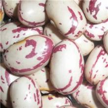 american type light speckled kidney bean